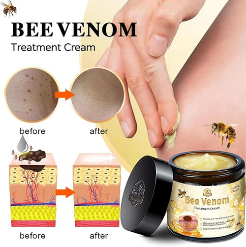 Bee Venom Skin Treatment Cream, Professional Bee Venom Treatment Cream, Bee Venom Cream for Removing and Repair, Natural Bee Venom Treatment Cream for All Parts of The Body
