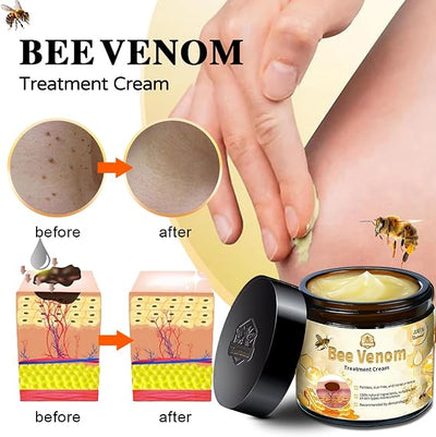 Bee Venom Skin Treatment Cream, Professional Bee Venom Treatment Cream, Bee Venom Cream for Removing and Repair, Natural Bee Venom Treatment Cream for All Parts of The Body