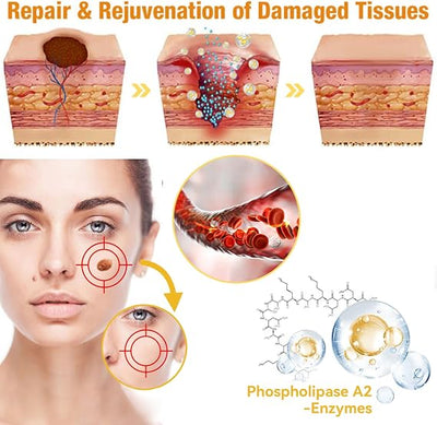 Bee Venom Skin Treatment Cream, Professional Bee Venom Treatment Cream, Bee Venom Cream for Removing and Repair, Natural Bee Venom Treatment Cream for All Parts of The Body