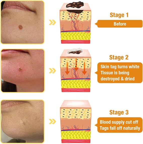 Bee Venom Skin Treatment Cream, Professional Bee Venom Treatment Cream, Bee Venom Cream for Removing and Repair, Natural Bee Venom Treatment Cream for All Parts of The Body