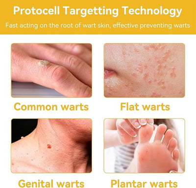 Bee Venom Skin Treatment Cream, Professional Bee Venom Treatment Cream, Bee Venom Cream for Removing and Repair, Natural Bee Venom Treatment Cream for All Parts of The Body